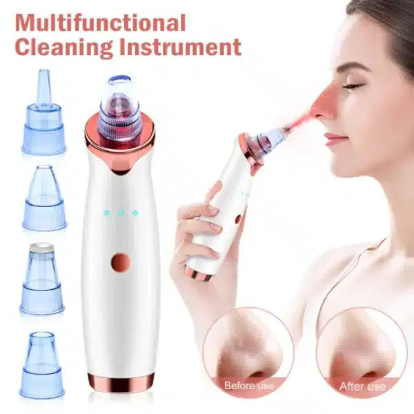 Vacuum Blackhead Remover Face Black Spots Cleaner White Dot Pimple Removal